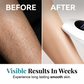 Professional IPL Laser Hair Removal Handset